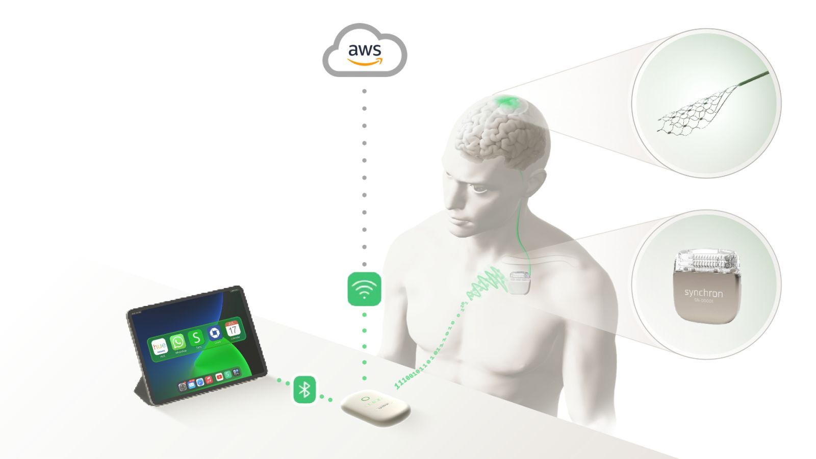 synchron stentrode accessibilite cerveau