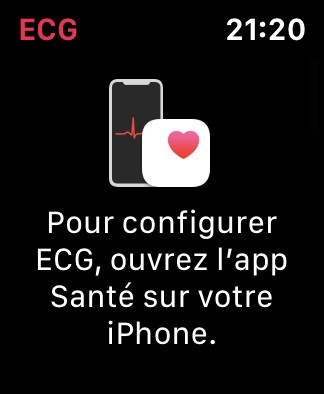 apple watch ecg apple watch ecg
