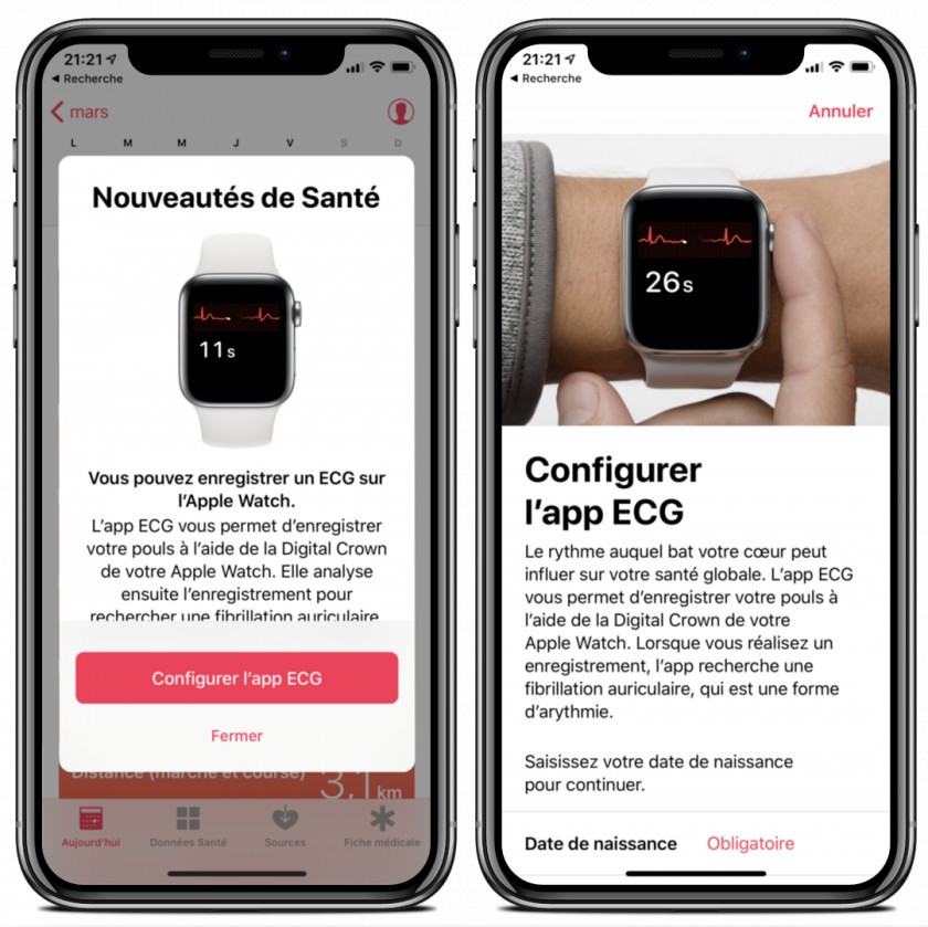 application sante electrocardiogramme configuration apple watch application sante electrocardiogramme configuration apple watch
