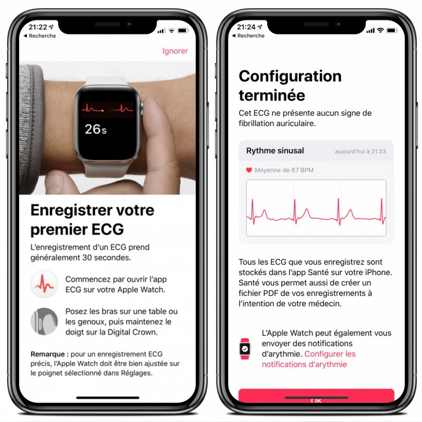 application sante electrocardiogramme rythme cardiaque prise apple watch application sante electrocardiogramme rythme cardiaque prise apple watch