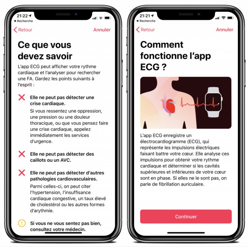 explication ecg apple watch francais explication ecg apple watch francais