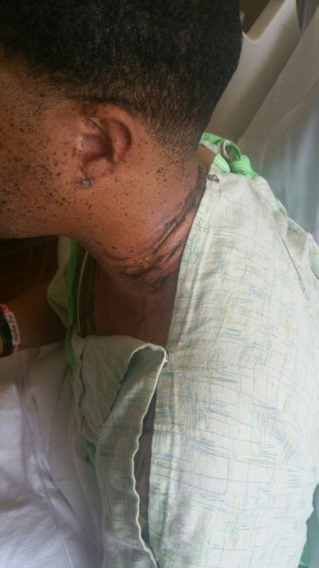 cou electrocute iphone cou electrocute iphone