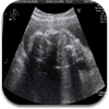 baby-ultrasound-1 baby-ultrasound-1