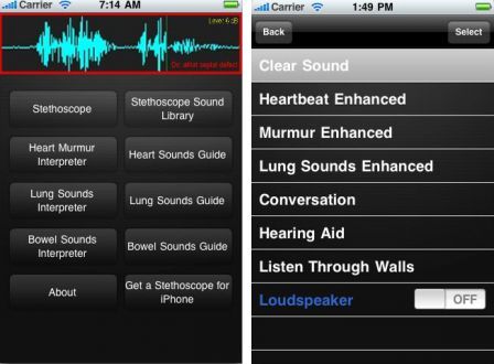 istethoscope-expert-1 istethoscope-expert-1