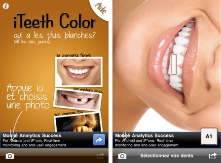 iteeth-color-free-1 iteeth-color-free-1