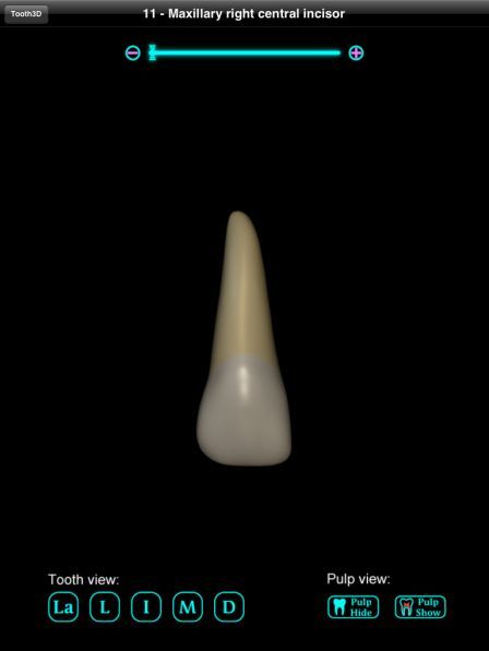 tooth-3d-ipad tooth-3d-ipad