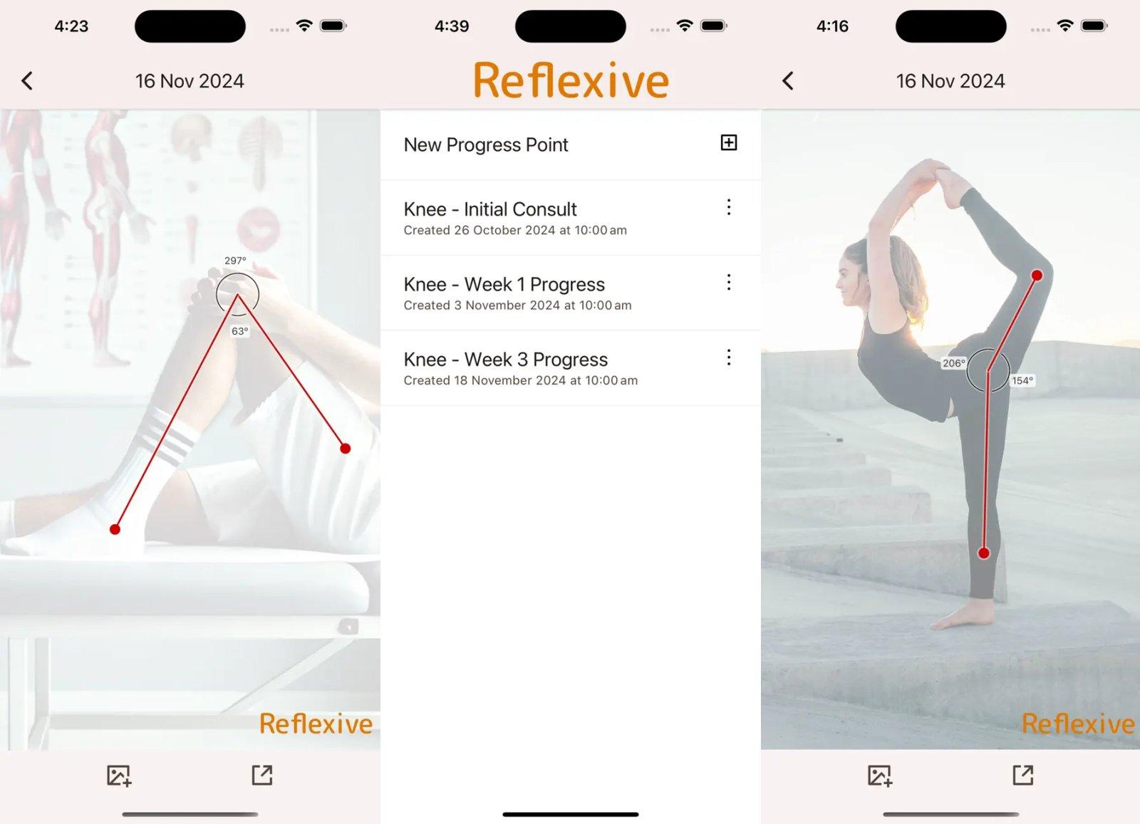 reflexed capture app ipa iphone